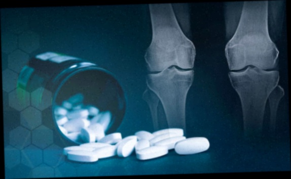 Anti-inflammatoire naturel articulations pas cher