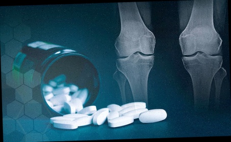 Pommade arthrose des mains pas cher